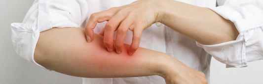 Latexallergie bei Einweghandschuhen - Symptome, Ursachen und Alternativen